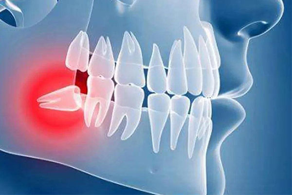 智齿旁边长白色泡是怎么回事？中老