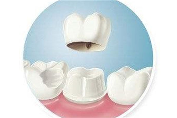 补牙后多久能刷牙吃饭？中老年口腔3小时快速修复秘诀公开！