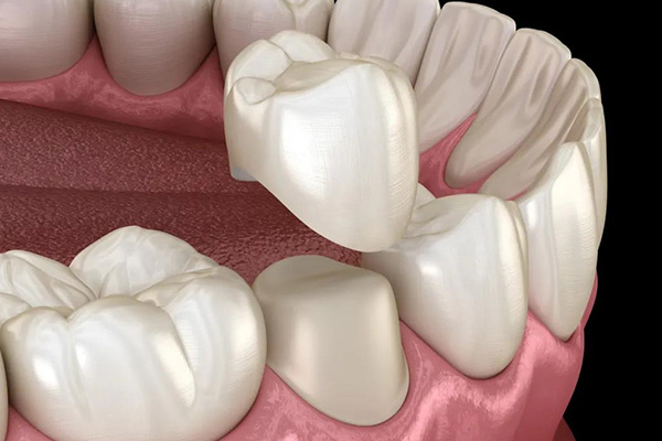 小孩乳牙坏了需要补牙吗？这些原因告诉你答案！