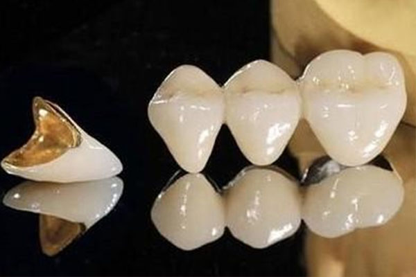 烤瓷牙多久换一次比较好？中老年口