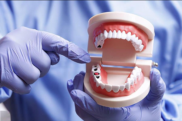 活动假牙是不是能不带就不戴？中老