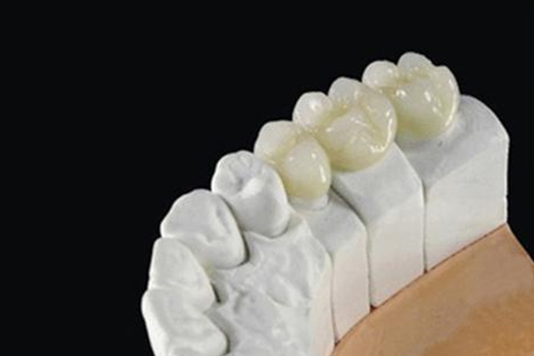 缺牙困扰？揭秘义齿加工厂高效背后