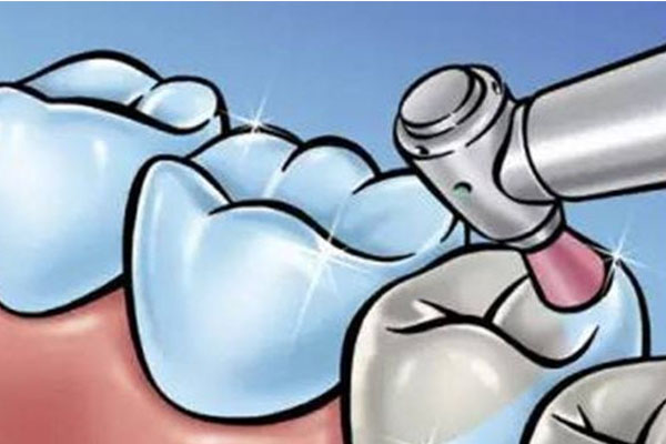 补牙填充物当天掉落？别慌！中老年