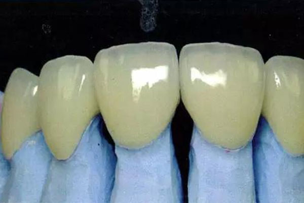 假牙吞进肚子怎么办？中老年口腔教