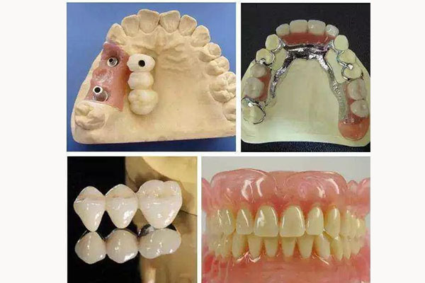 义齿加工厂多少钱一颗？批量制作高