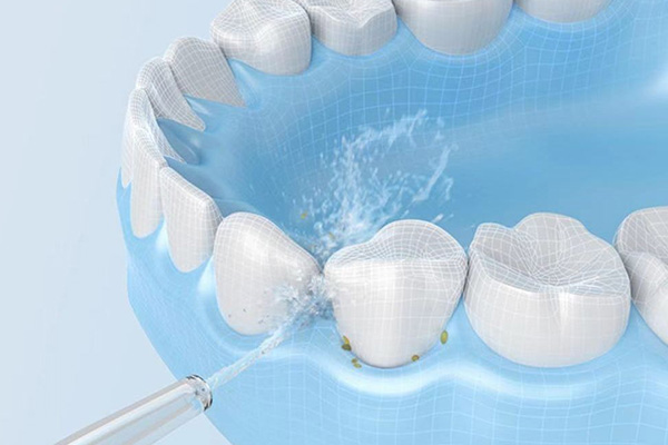 中老年人牙结石多可以安全洗牙吗？中老年口腔专家揭秘高效无