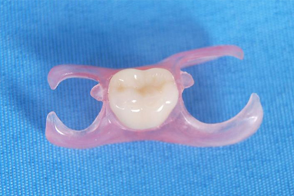 70岁缺牙选择种植牙还是活动假牙更合适？中老年口腔为您解析