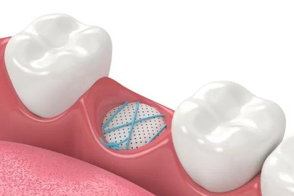 牙齿脱落的征兆及女性快速恢复的药物推荐