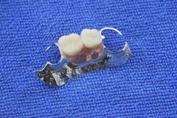 活动假牙该如何正确放置和使用？中