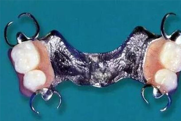 可摘局部义齿的四大核心部件揭秘！中老年口腔专家教你轻松掌