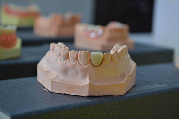 活动义齿与活动假牙哪个更适合中老