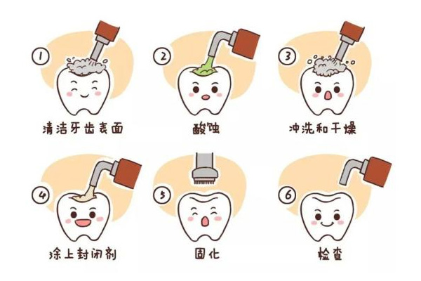 儿童涂氟后不良反应及应对方法