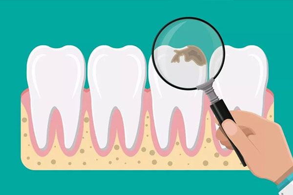 古时候没有现代牙科技术 蛀牙怎么办？中老年口腔揭秘古代护牙