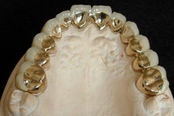 长期戴活动假牙真的会伤害邻牙吗 中