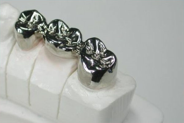 镶牙后多久能喝酒？中老年口腔修复