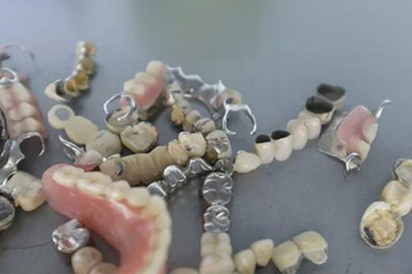 活动假牙可摘隐形义齿嘛？中老年口