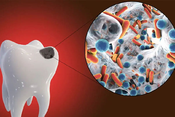 中老年口腔：补牙价格亲民，适合您的选择