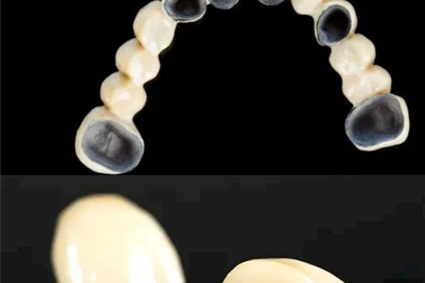 中老年缺牙患者的福音：臻致义齿技