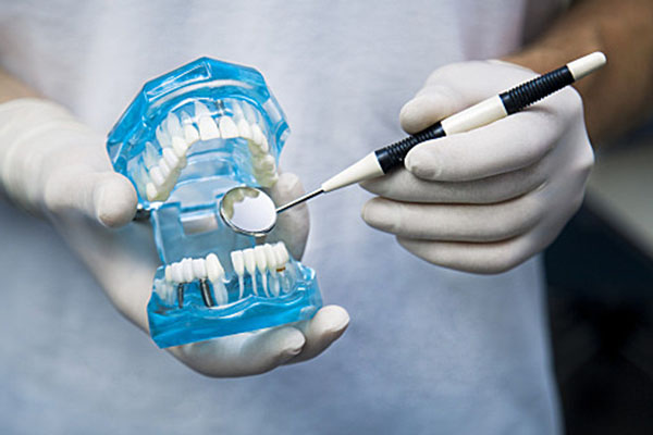 中老年口腔：一颗活动假牙需要每天拿下来吗？