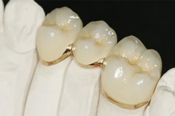 假牙患者做CT有影响吗？中老年口腔高