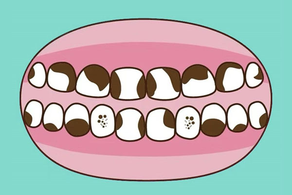 5个快速止痛妙招，中老年口腔专家推