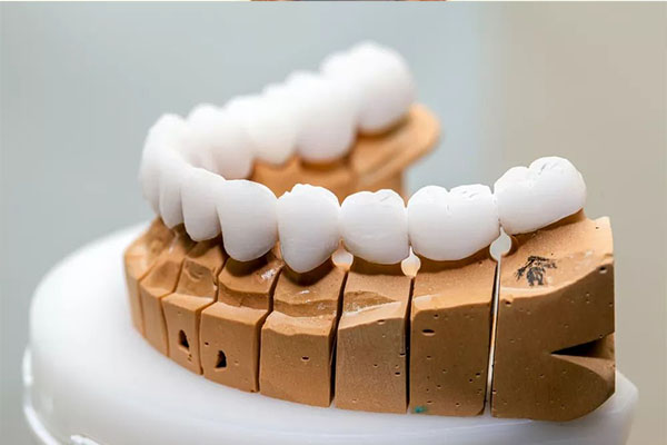 活动假牙一副多少钱？中老年口腔为您带来高性价比的选择