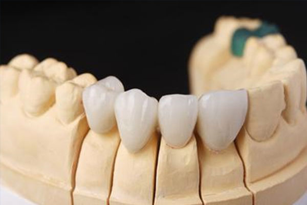 流体树脂充填医保费用明细来了！中