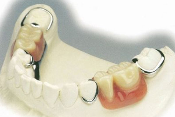 活动假牙最好的材质是什么材料？中老年口腔为您解析舒适耐用