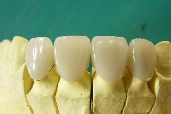 纯钛假牙能做核磁共振吗多少钱？中老年口腔批量修复缺牙仅需