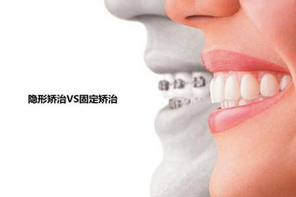 南京哪里矫正牙齿比较好？中老年口腔为您推荐高效解决方案