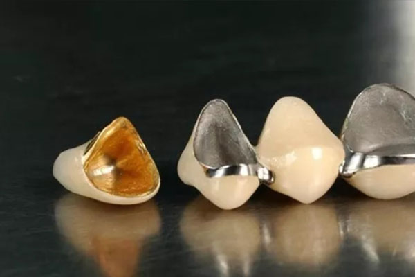 烤瓷牙VS全瓷牙，中老年缺牙如何选？