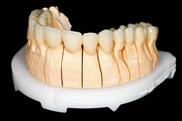 牙冠不一定是全瓷牙，中老年口腔为
