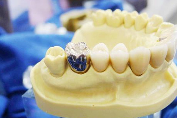 中老年口腔专家解析：义齿的作用与优缺点，助您重拾好牙口！