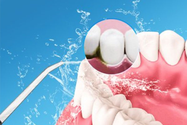 9岁孩子牙齿有黑斑可以洗牙吗？中老年口腔专家带您科学护齿