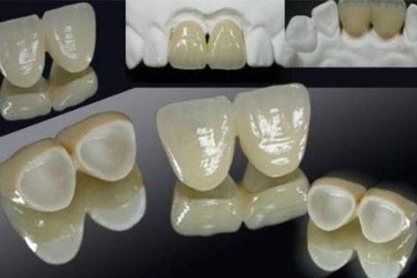 别再担心烤瓷牙基牙腐烂！中老年口腔批量修复效率提升秘诀