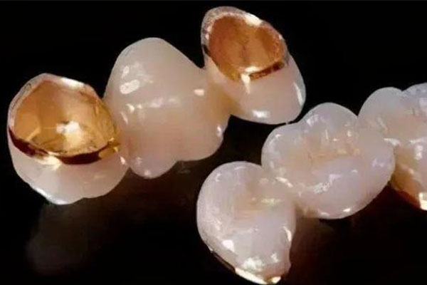 镶牙医保有报销吗？中老年口腔批量