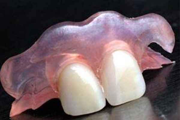 中老年缺牙困扰？沟槽式精密附件义