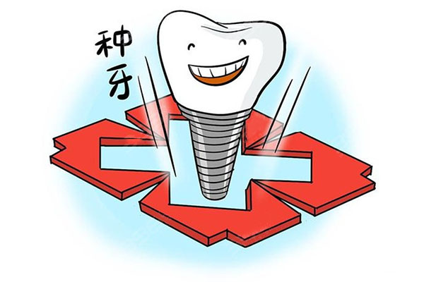 种牙不再难批量解决缺牙困扰