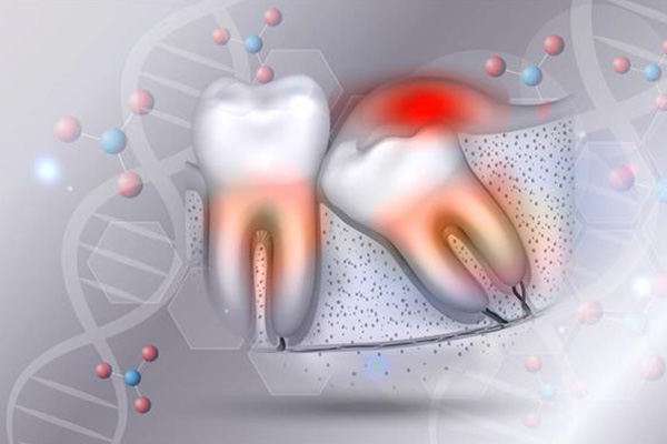 拔智齿多久恢复？中老年口腔为您解