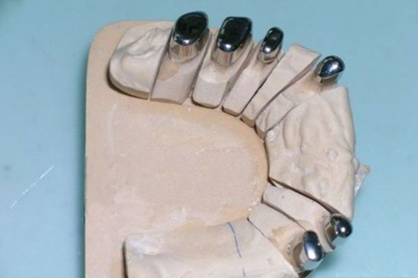 缺牙困扰？中老年口腔揭秘义齿基托材质选择秘诀！