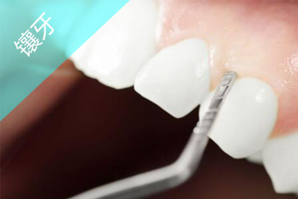 镶牙之前的临时牙怎么拿下来