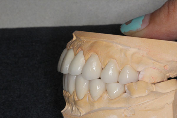 中老年口腔：一颗活动假牙的价格到底值不值？