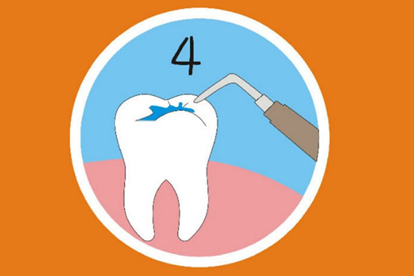 中老年口腔：牙齿涂氟前后对比，预防龋齿效果立竿见影！