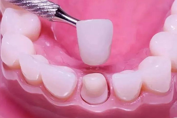 中老年口腔专家解答：补牙后一碰就疼怎么办？推荐这些药物和