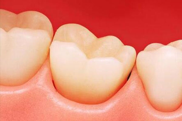 牙齿为什么松动了一半？中老年口腔批量修复技术让缺牙不再困