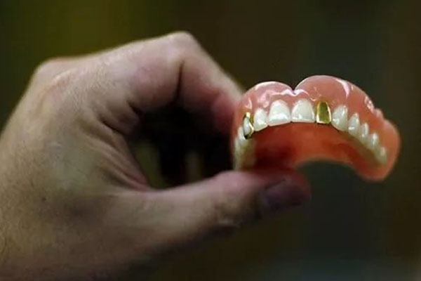 单颗活动假牙哪种好？中老年口腔推荐高效解决方案