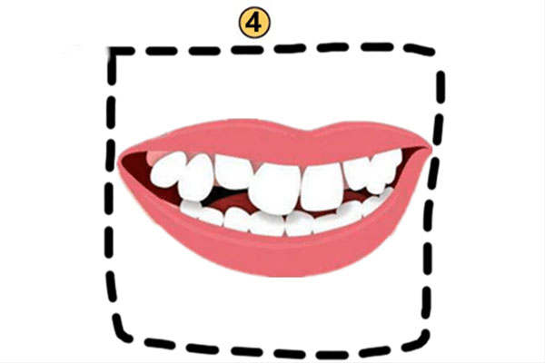 牙齿松动疼痛怎么办？中老年口腔专家建议：这些方法快速解决