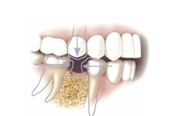 脂肪粒自行脱落的方法，中老年口腔为您解决困扰