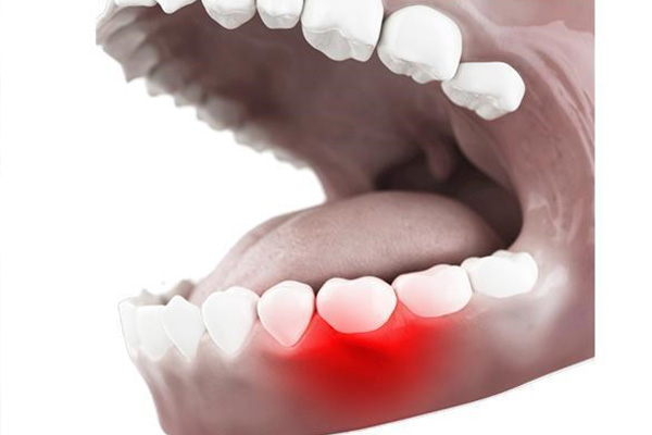 孩子牙疼哭闹？中老年口腔批量修复