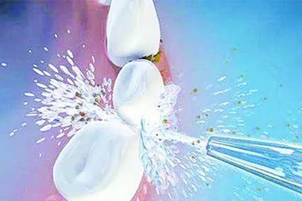 洗牙去私人医院好还是公立医院好一点？中老年口腔：专业高效